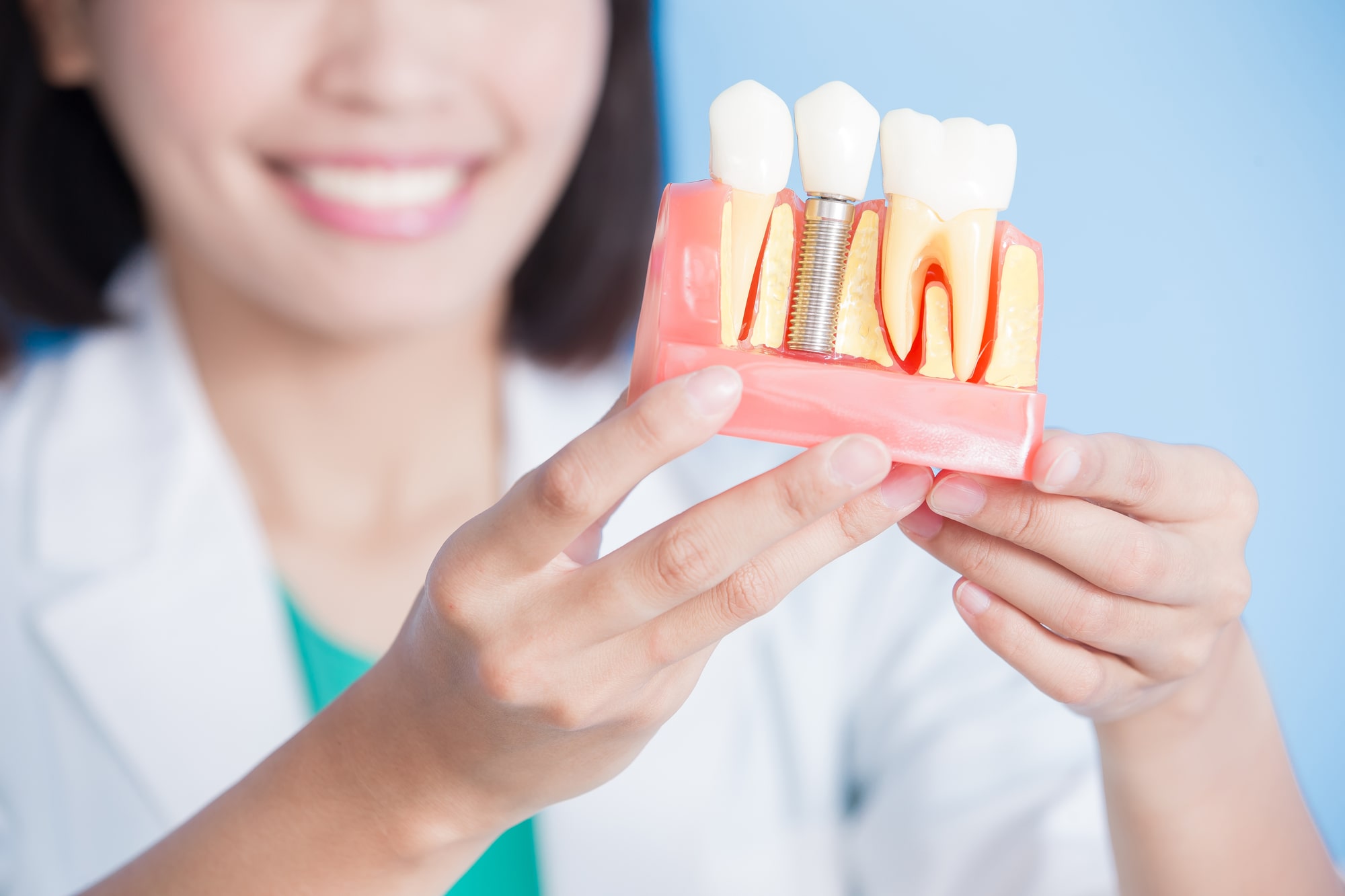 Woman dentist with implant tooth model on the blue background