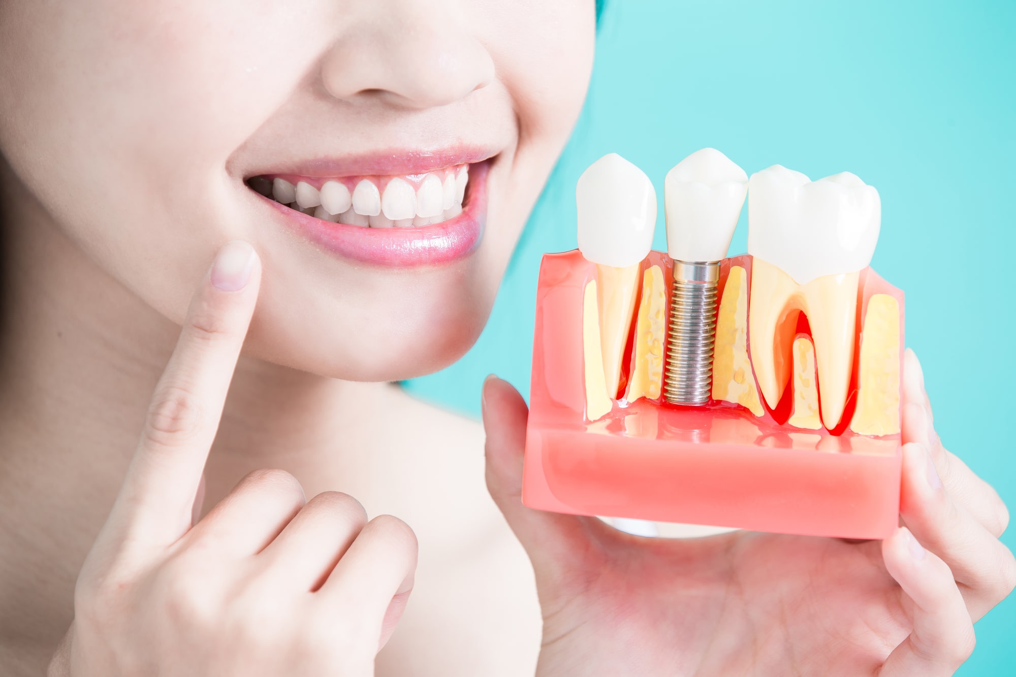Woman holding tooth implant model on green background